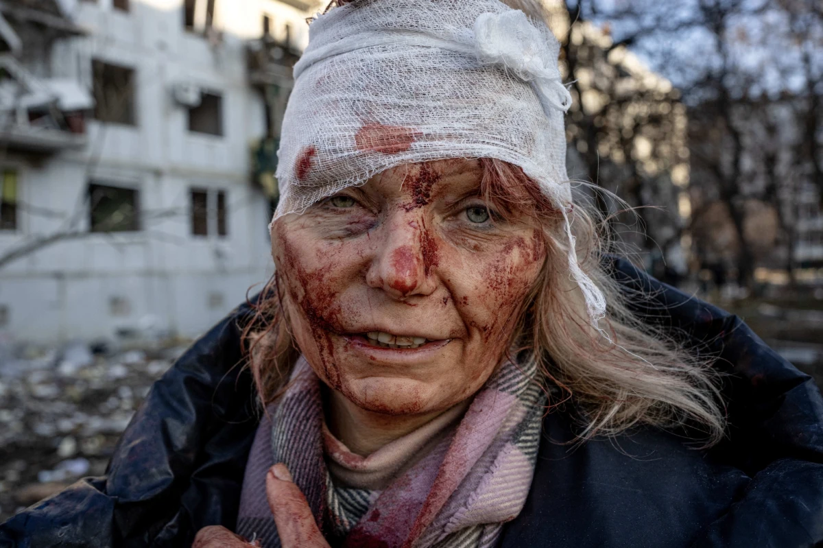 Staranny manicure zdobiący dłoń martwej kobiety. Obrońca Azowstalu stojący w promieniach słońca przedzierających się przez stalową konstrukcję. Ukraiński jeniec wyniszczony po pobycie w rosyjskiej niewoli. Wcześniaki leżące na łóżkach polowych zamiast w inkubatorach. Kilkuletnia dziewczynka śpiewająca "Mam tę moc" w schronie. Między innymi te zdjęcia i nagrania stały się symbolem trwającej od roku inwazji Rosji na Ukrainę.