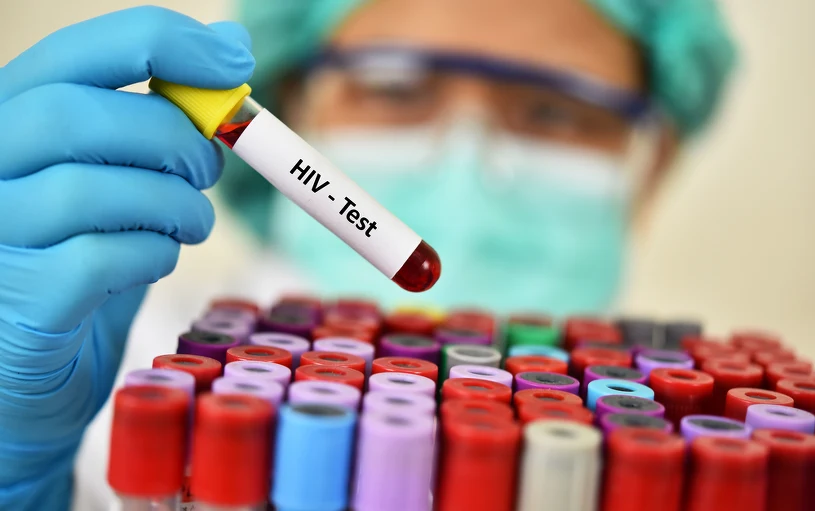 Testuje nową metodę walki z HIV przy użyciu lek przeciwnowotworowego