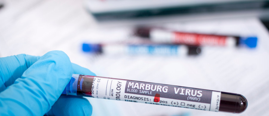 Wirus Marburg zbiera śmiertelne żniwo. W położonej w Afryce Środkowej Gwinei Równikowej odnotowano przypadki zachorowań i zgonów związanych z zakażeniem tym patogenem. Czym się charakteryzuje? Czy grozi nam nowa epidemia? 