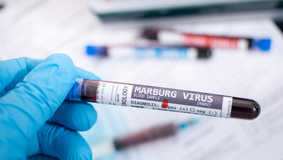 Nawet 90-proc. śmiertelność wirusa Marburg. Jakie daje objawy?