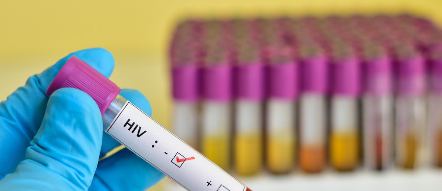 Potwierdzono trzeci na świecie przypadek wyleczenia pacjenta z wirusem HIV, który jednocześnie chorował na nowotwór. Było to możliwe dzięki przeszczepowi komórek macierzystych – poinformowali lekarze ze Szpitala Uniwersyteckiego w Düsseldorfie. 