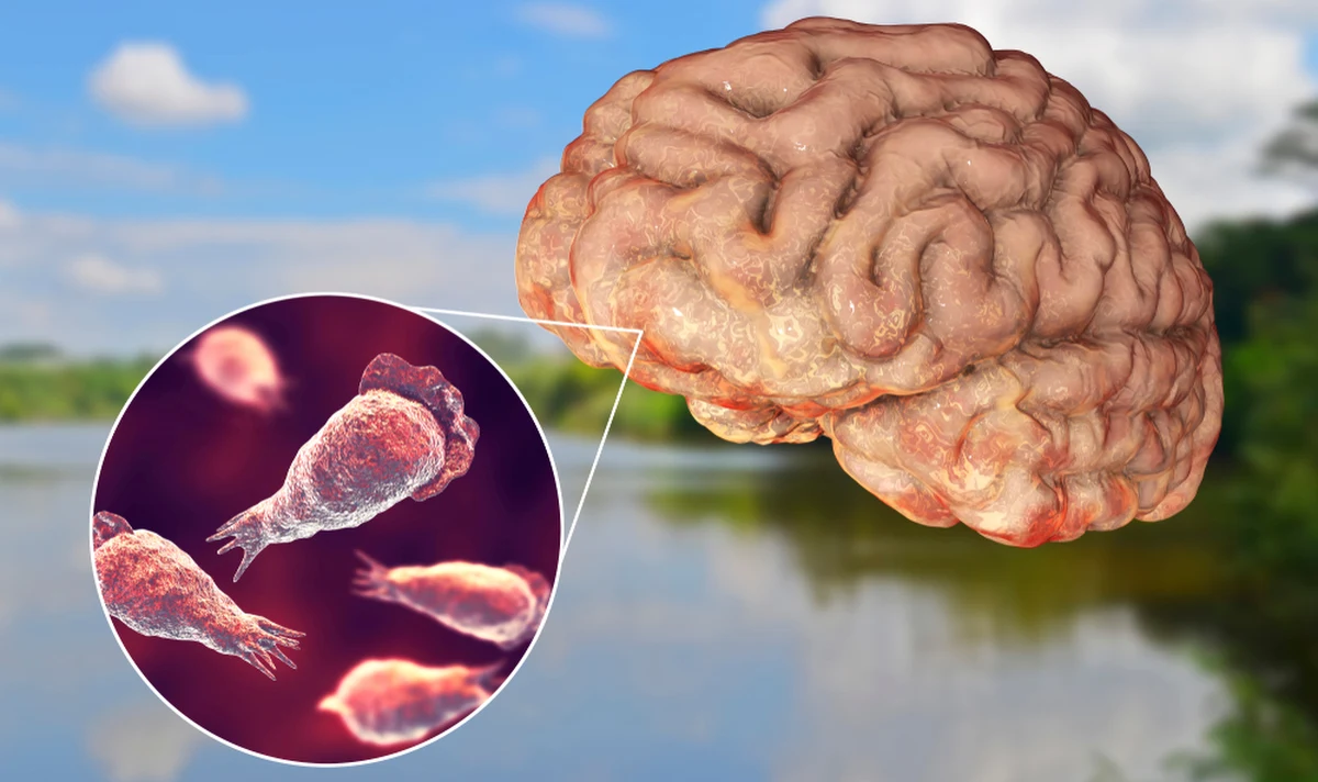 Mieszkaniec amerykańskiej Florydy zmarł na rzadką infekcję wywołaną przez "zjadający" mózg pierwotniak po użyciu nieprzegotowanej wody z kranu - poinformowały władze lokalne i federalne. Istnieją podejrzenia, że chodzi o amebę Naegleria fowleri.