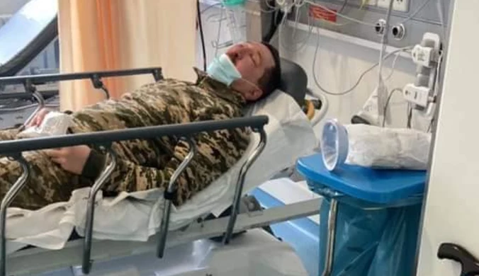 Ukraiński żołnierz dotkliwie pobity w Niemczech. "Złamana szczęka, wstrząs mózgu"