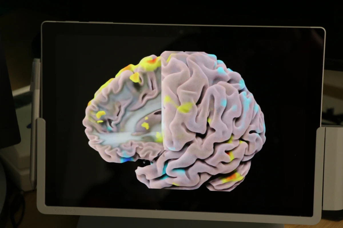 Centrum Badań Mózgu otwarto dziś na Uniwersytecie Jagiellońskim w Krakowie. Nowa jednostka międzywydziałowa zintegruje wszystkie medyczne i badawcze prace dotyczące mózgu. W placówce przy ulicy Kopernika, zainstalowano rezonans magnetyczny wraz ze specjalistycznym skanerem przeznaczonym do badań naukowych ośrodkowego układu nerwowego