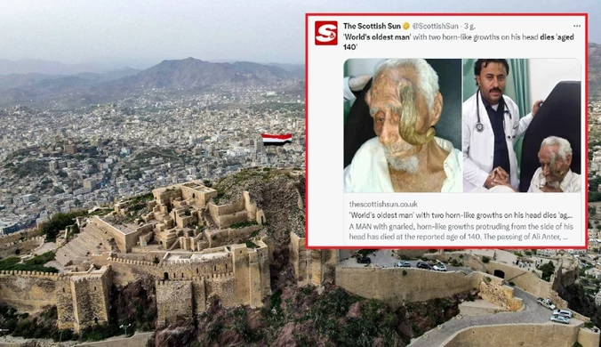 Jemen: "Człowiek-kozioł" nie żyje. Miał umrzeć w wieku 140 lat