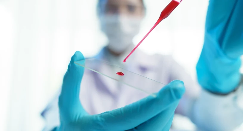 Jedna kropla krwi i 10 minut. Szybki test pomoże ratować rannych