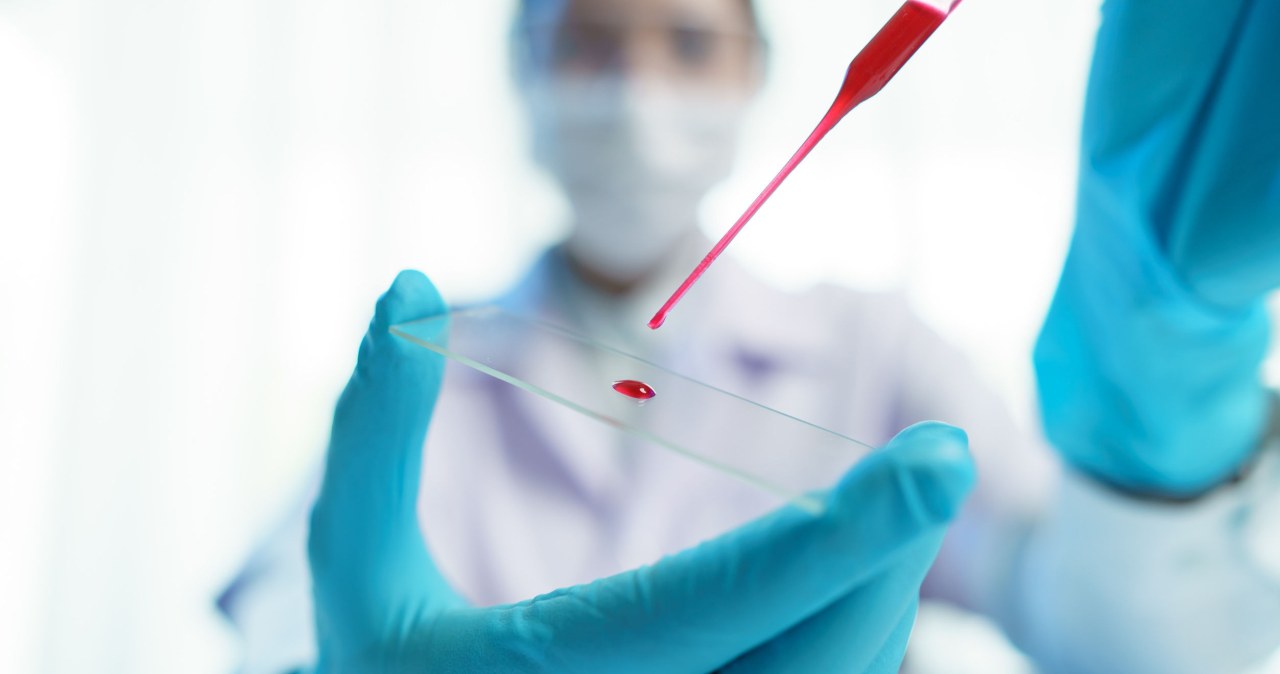 Przełomowe badanie krwi. Wykrywa raka 3 lata przed pojawieniem się objawów