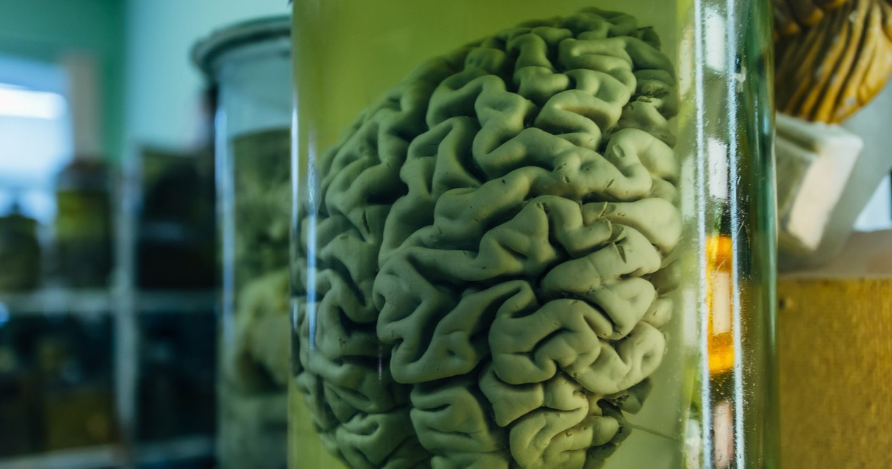 Wizyta w piwnicy duńskiego Odense University to doświadczenie tylko dla ludzi o mocnych nerwach, bo naukowcy tej placówki dysponują największą na świecie kolekcją ludzkich mózgów. Badacze mieli nadzieję, że znajdą z ich pomocą odpowiedź na pytanie, gdzie w mózgu "ukrywają" się choroby psychiczne.