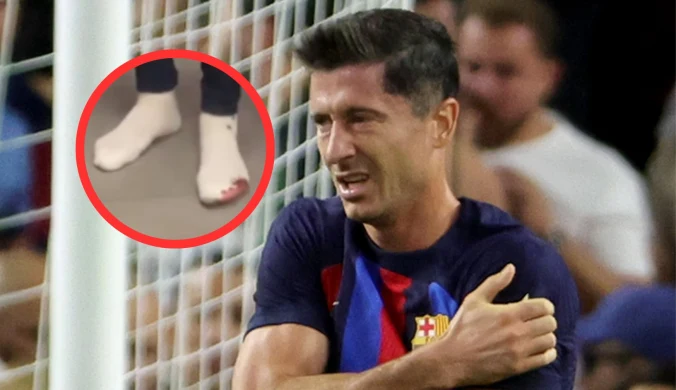 Zwycięstwo okupione cierpieniem. Tak wyglądała stopa "Lewego" po El Clasico