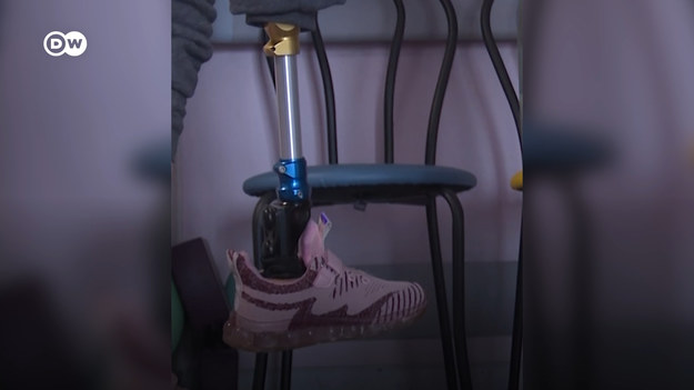 Kilkuletnia dziewczynka w Ukrainie straciła nogę, kiedy rosyjski pocisk zniszczył dom jej rodziny. Dzięki lekarzom stawia pierwsze kroki. Pomagają jej w tym proteza i silna wola.