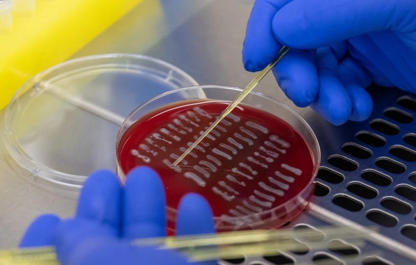 Walka z bakterią E. coli. Naukowcy na tropie rozwiązania