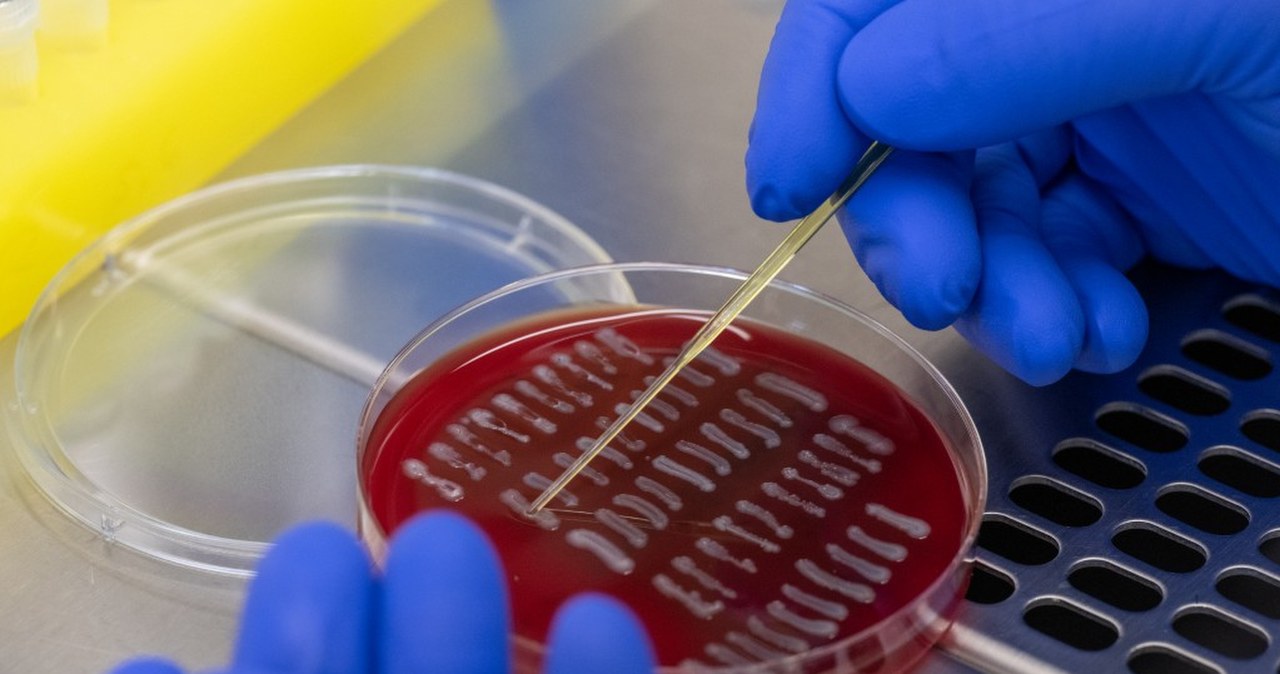 Walka z bakterią E. coli. Naukowcy na tropie rozwiązania