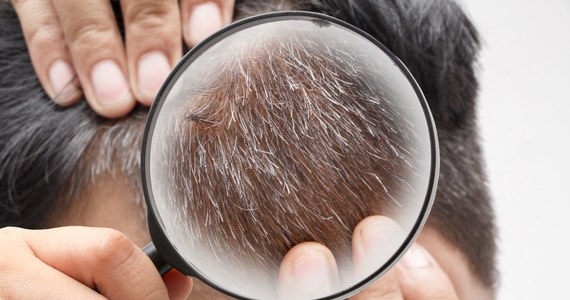 Naukowcy próbują lepiej zrozumieć proces siwienia włosów. Wyniki najnowszych badań pokazują, że być może będzie się dało go odwrócić – czytamy w czasopiśmie „Nature”.