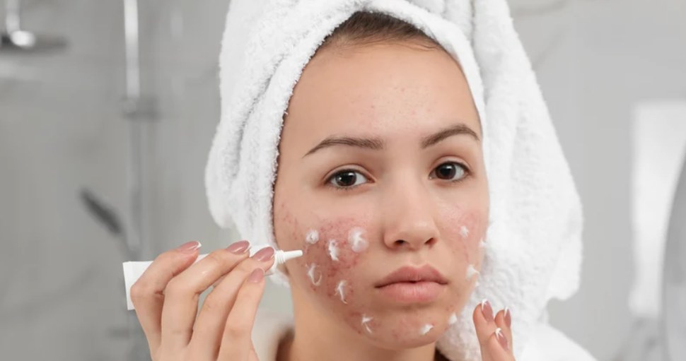 Zapomnij o niedoskonałościach. Kup za 5 złotych i ciesz się zdrową cerą