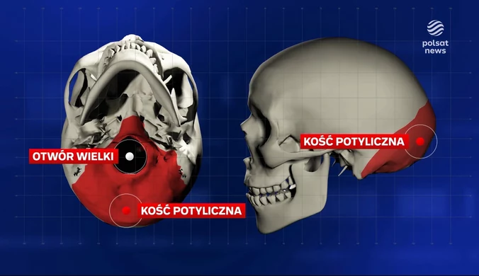 ''Wydarzenia'': Lekarze z Olsztyna na ratunek dziecku z rzadką wadą genetyczną  