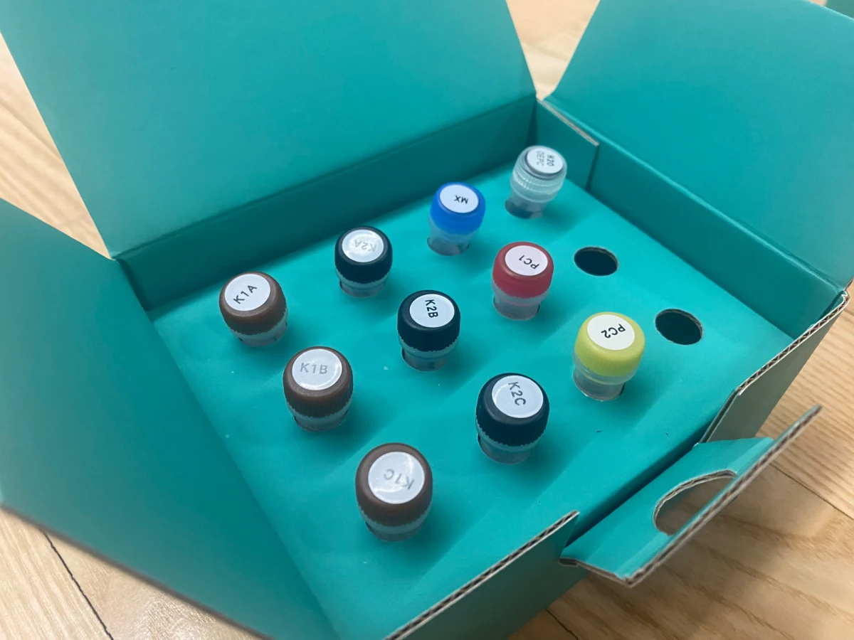 Pierwszy na świecie test diagnostyczny oceniający ryzyko ciężkiego przebiegu infekcji Covid-19 opracowali naukowcy z Państwowego Instytutu Medycznego MSWiA. Jest on już wykorzystywany w szpitalu MSWiA.