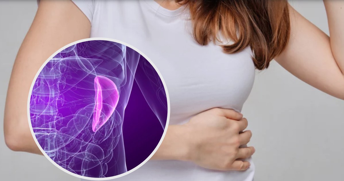 Powiększenie śledziony (splenomegalia) - jak się objawia i co może ...