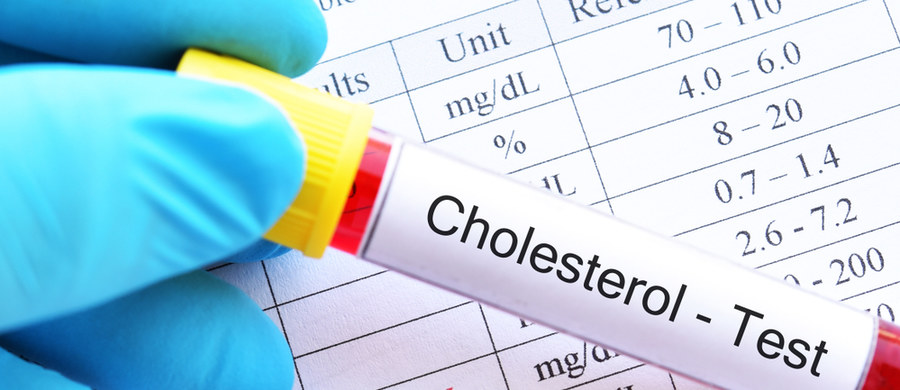 Cholesterol to związek zaliczany do steroli, które należą do lipidów. Pełni on bardzo ważną funkcję w naszym organizmie, bo jest niezbędny do wytwarzania hormonów płciowych, nadnerczowych, witaminy D3, oraz kwasów żółciowych. Poza tym jest składnikiem błony komórkowej wszystkich komórek naszego organizmu.