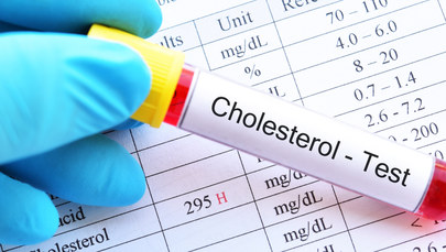 Jakie powinny być prawidłowe wyniki badania cholesterolu?