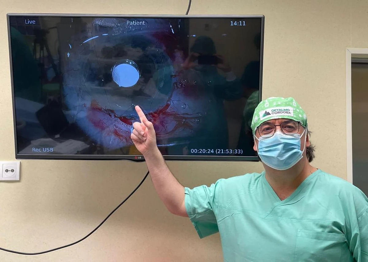 ​Szansa na widzenie dla chorych na AMD, czyli starcze zwyrodnienie plamki żółtej. Lubelscy okuliści jako pierwsi w Polsce wszczepili soczewkę teleskopową. To zupełnie nowe rozwiązanie, które daje nadzieję na samodzielne funkcjonowanie w sytuacji, gdy zwyrodnienie praktycznie uniemożliwia widzenie.