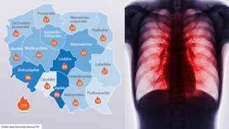 Lekarka nie ma wątpliwości: Zdrowie Polaków zagrożone. Mapa pokazuje skalę problemu