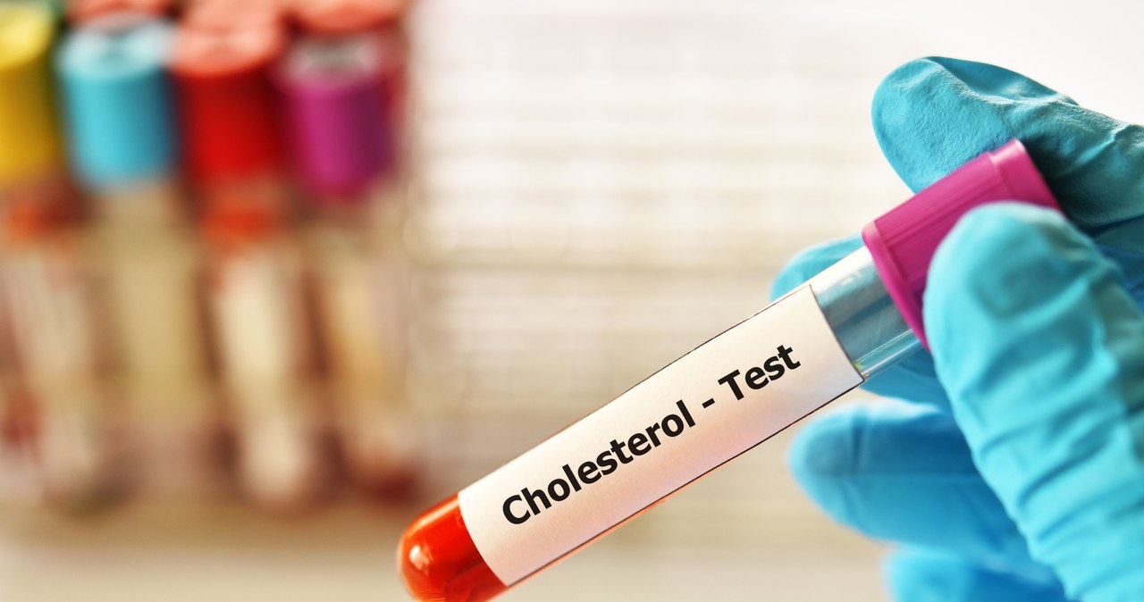 Cholesterol, zwiększa, ryzyko, występowania, miażdżycy, zawału, serca, udaru, mózgu, prowadzi, rozwoju, chorób, sercowonaczyniow Wysoki cholesterol, czyli jaki? Takie są normy i sposoby na zbicie złego cholesterolu