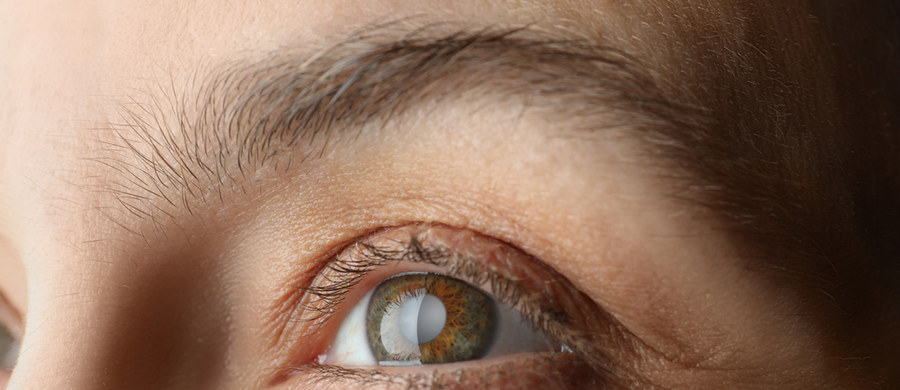 Zaćma to najczęściej występująca choroba oczu. Cierpi na nią już ok. 60 proc. populacji w wieku od 65-75 roku życia. Co istotne, problem zmętnienia soczewki zaczyna dotyczyć coraz młodszych, nawet 40-letnich osób! Czym dokładnie jest zaćma, jak ją rozpoznać oraz kiedy zwrócić się z problemem do lekarza, tłumaczy okulistka dr n. med. Violetta Tomczyk-Dorożyńska. 