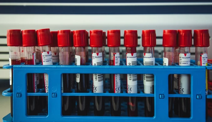 Brytyjscy naukowcy: Dzięki badaniom krwi możliwa wcześniejsza diagnoza