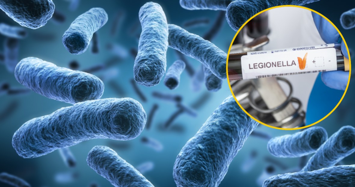 Legionella w Polsce. Jak się chronić przed legionellą? Geekweek w