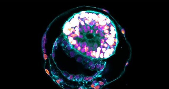 Po raz pierwszy naukowcom udało się w całkowicie sztuczny sposób stworzyć kopię 2-tygodniowego ludzkiego embrionu. Zarodek powstał bez jajeczka i spermy. Wykorzystano do tego komórki macierzyste.