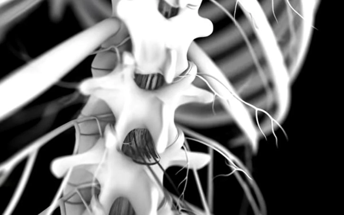 Wszczepienie implantu w okolicę lędźwiową kręgosłupa przywróciło zdolność poruszania się pacjentowi z zaawansowaną chorobą Parkinsona - informuje „Nature Medicine”. Informację ujawniono po dwóch latach od przeprowadzenia zabiegu. 