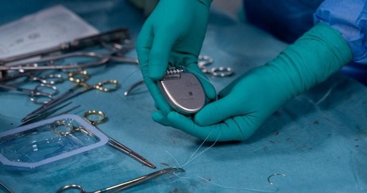 W dwóch warszawskich ośrodkach po raz pierwszy w Polsce poza badaniami klinicznymi wszczepiono pacjentom innowacyjne kardiowertery-defibrylatory serca EV-ICD Aurora, które mają chronić przed nagłym zgonem sercowym.