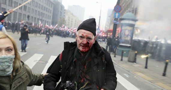 Sąd Rejonowy dla Warszawy-Śródmieścia nie uwzględnił zażalenia fotoreportera Tomasza Gutrego na postanowienie prokuratury w sprawie umorzenia śledztwa dotyczącego przekroczenia uprawnień przez policjantów 11 listopada 2020 roku w czasie Marszu Niepodległości. To wtedy Gutry został postrzelony przez funkcjonariusza z broni gładkolufowej.