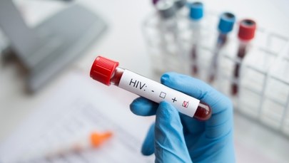 Test jest darmowy, anonimowy i szybki. HIV można leczyć, jeśli zakażenie wykryje się szybko