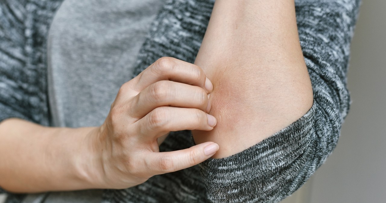 To częsty objaw niedoboru witaminy C. Odpowiada nie tylko za odporność