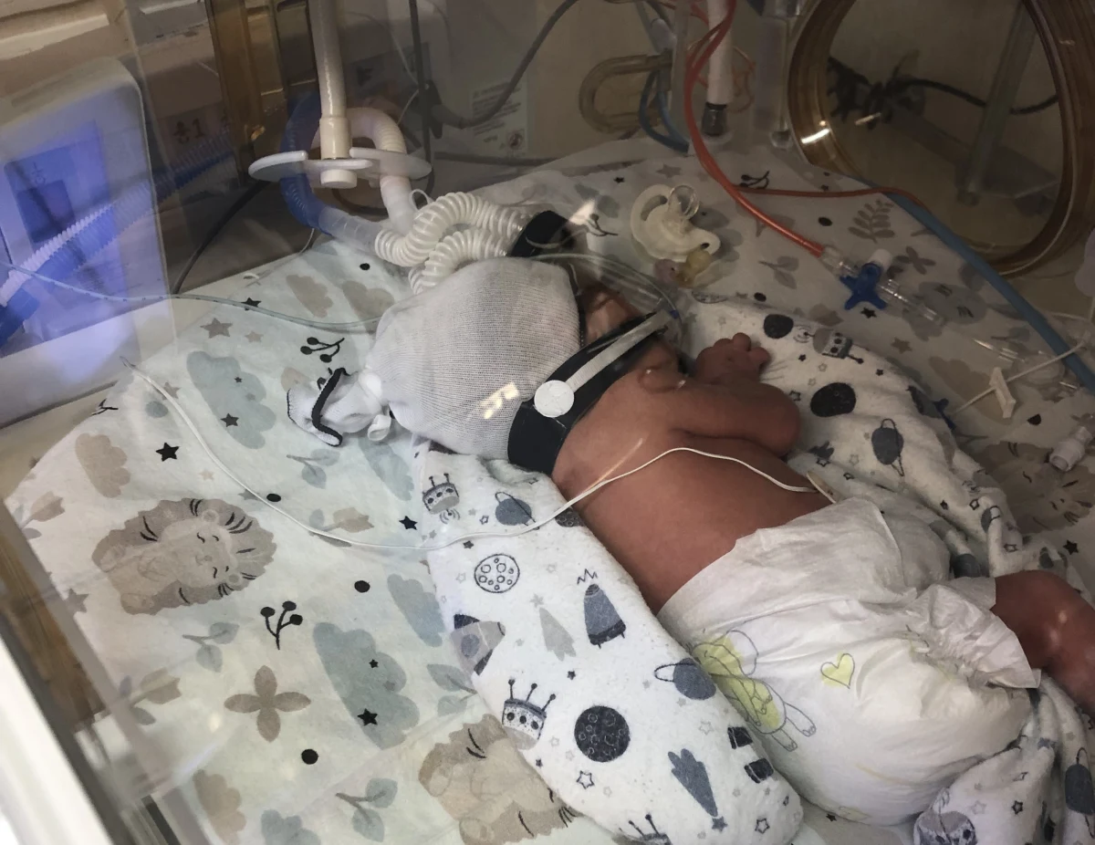 Taki poród przytrafia się raz na siedemset tysięcy! W poznańskim szpitalu ginekologiczno-położniczym przy ul. Polnej przyszły na świat czworaczki. To cztery dziewczynki - Lilianna, Laura, Hanna i Sofia.