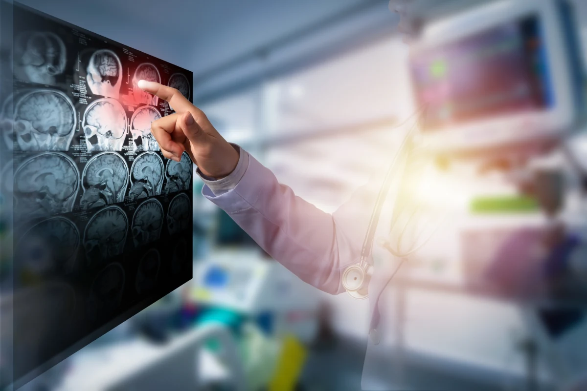 Zespół z USA z pomocą druku 3D otrzymał ludzką tkankę mózgową, która działa i rośnie podobnie jak naturalna. To potężne narzędzie do badania różnorodnych zaburzeń, w tym choroby Alzheimera czy Parkinsona.