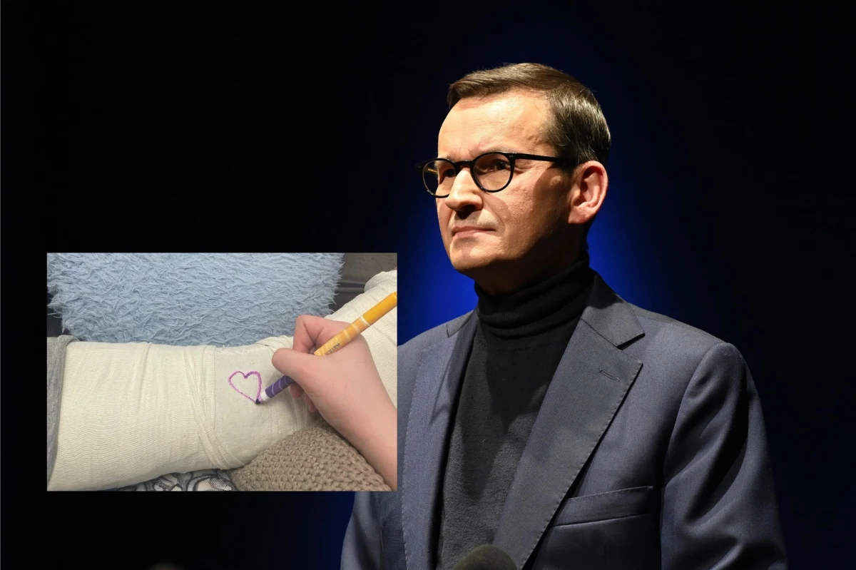 Mateusz Morawiecki kontuzjowany! Były premier zamieścił w mediach społecznościowych wpis ze zdjęciem. "Uważajcie na siebie" - ostrzegł polityk.