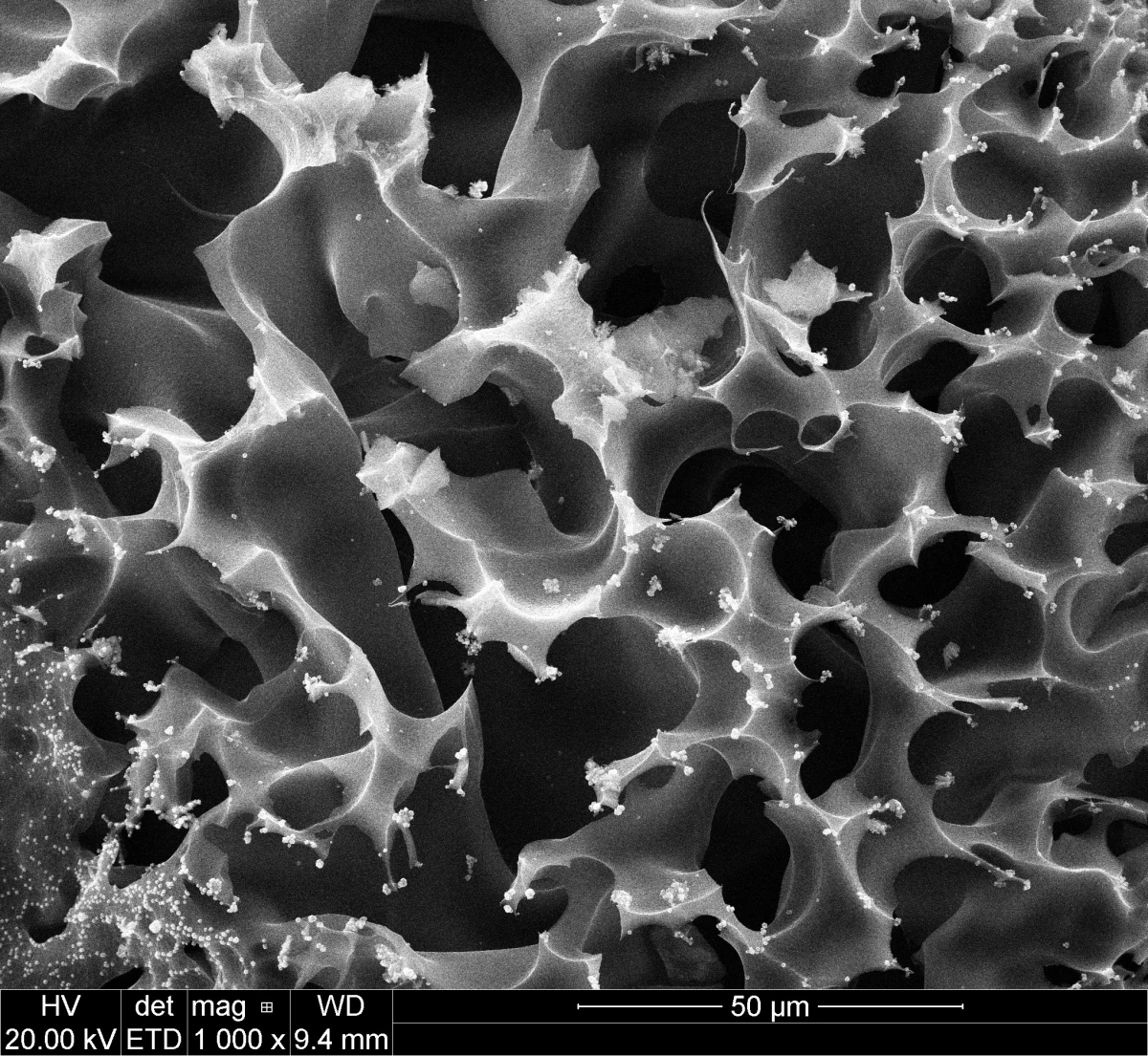 W Instytucie Kultury Miejskiej (IKM) w Gdańsku w niedzielę o godzinie 17 odbędzie się wernisaż wystawy "Szukając Przestrzeni". Zostanie na niej zaprezentowanych 40 prac artystyczno-naukowych, wykonanych wiązką elektronów. Są to zdjęcia codziennych przedmiotów wykonanych za pomocą specjalistycznego mikroskopu elektronowego.