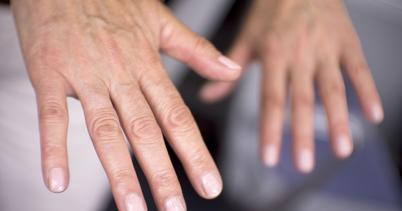 Ten objaw łatwo zlekceważyć. Drżenie rąk może mieć kilka ukrytych przyczyn