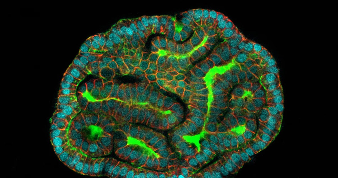 Naukowcy, pierwszy, wyhodowali, organoidy, przy, użyciu, komórek, macierzystych, pobranych, podczas, ciąży, zdaniem, pozwolą, ob Miniorgany z komórek pobranych od ciężarnych. To przełom
