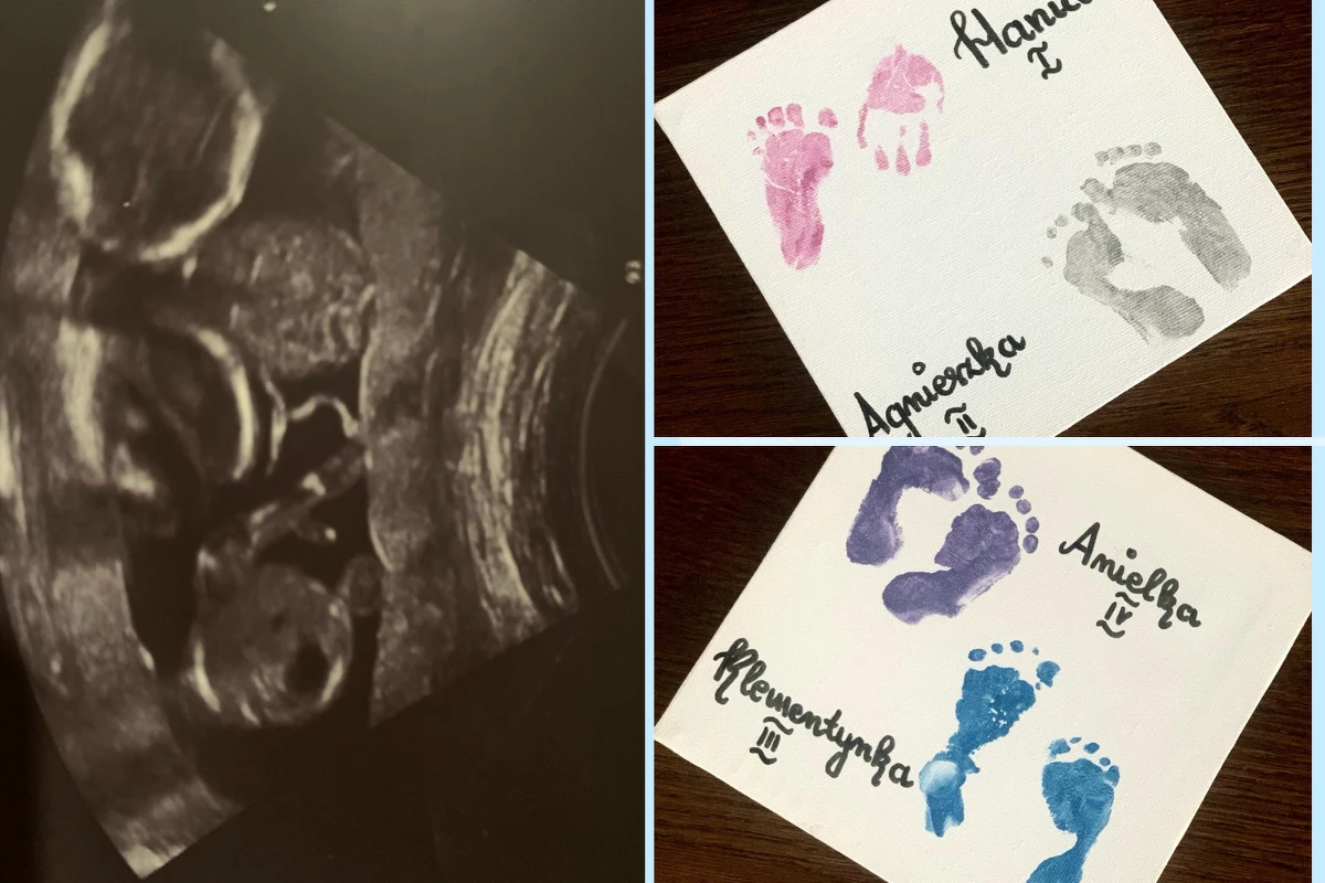 Czworaczki: Agnieszka, Hania, Klementynka i Anielka urodziły się w Szpitalu Uniwersyteckim w Krakowie. To kolejny udany poród wieloraczy w tej placówce w ostatnich latach po sześcioraczkach i pięcioraczkach – poinformował Szpital Uniwersytecki.