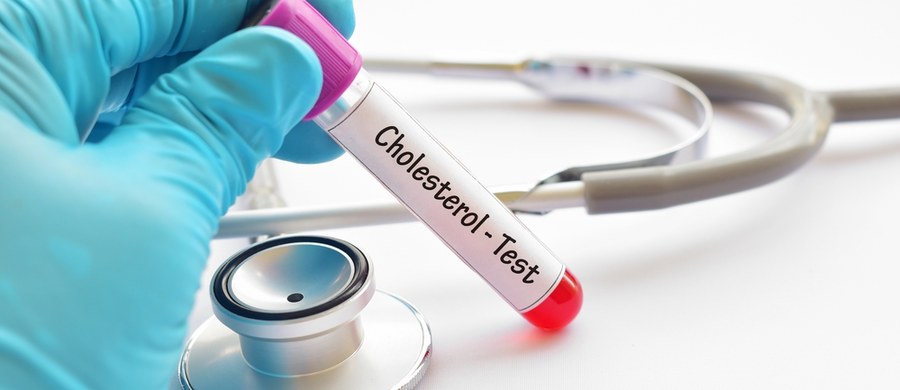 Poziom cholesterolu zależy od wielu czynników. Na większość mamy wpływ, bo dotyczą m.in. codziennej diety. By zbadać jego stężenie w organizmie, wystarczy wykonać proste badanie krwi. Kardiolog wyjaśnia, jaki wynik testu nie zagraża naszemu sercu. 
