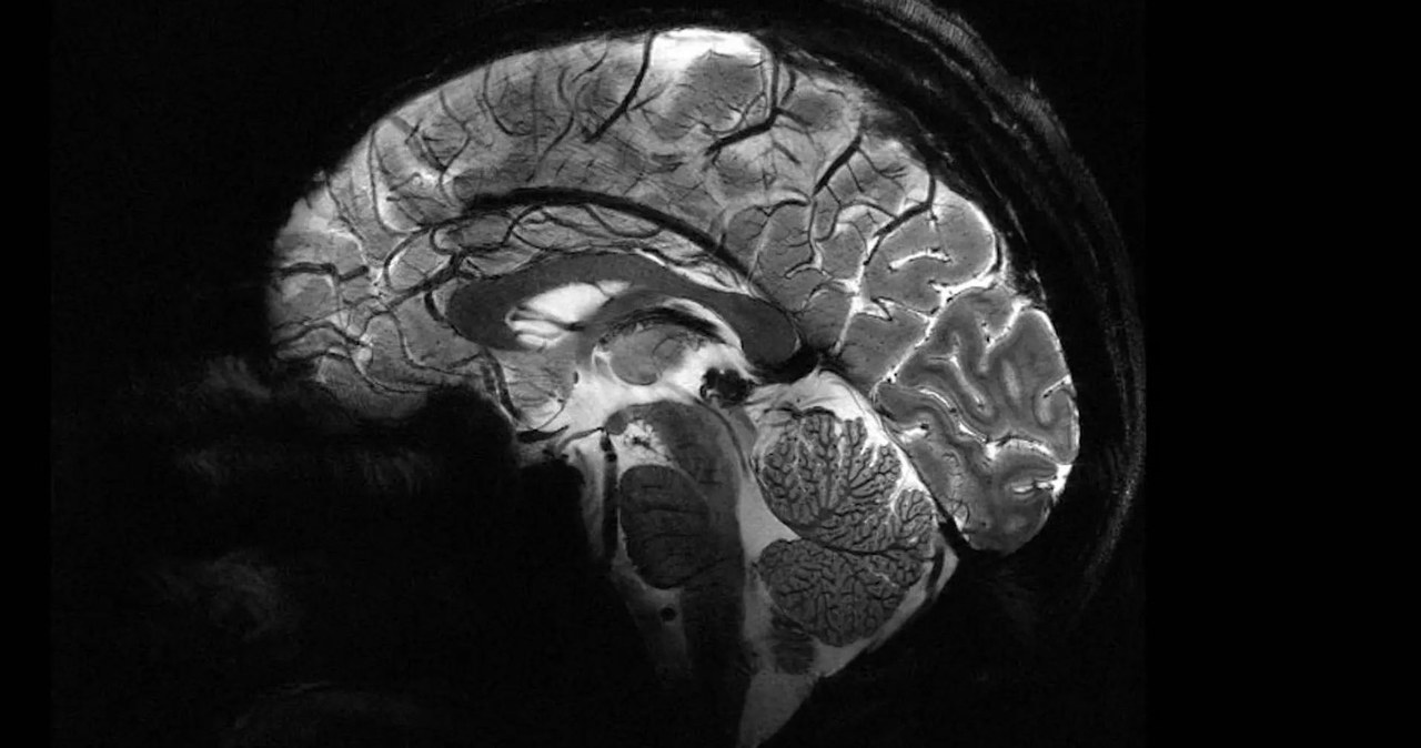 Najpotężniejsze urządzenie do rezonansu magnetycznego na świecie pokazuje swoją wartość. Dostarcza pierwsze skany mózgu w ultrawysokiej rozdzielczości, co pomoże lepiej zrozumieć naturę świadomości i leczyć choroby neurodegeneracyjne.