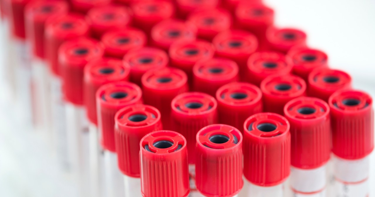 Robisz to przed badaniami krwi? Wyniki mogą być całkowicie niewiarygodne