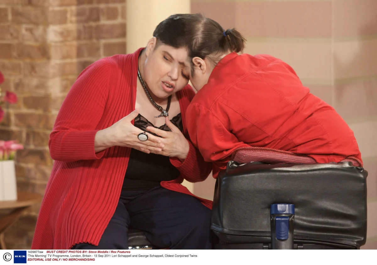 Słynne bliźnięta syjamskie Lori i George Schappell nie żyją. Przez 62 lata żyli złączeni głowami.