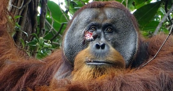 Po raz pierwszy w historii naukowcy zaobserwowali żyjącego na wolności orangutana, który leczył ranę samodzielnie przygotowywaną ziołową pastą. Orangutan mieszkający w indonezyjskim parku narodowym Gunung Leuser kurował się rośliną, używaną przez ludzi jako lek przeciwzapalny, podał w czwartek portal BBC.