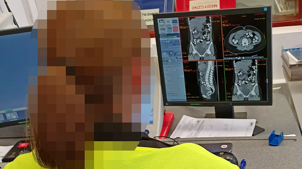 Łotyszka, która przemycała ponad kilogram kokainy, została zatrzymana na lotnisku Chopina w Warszawie. Większość - prawie 890 gramów - miała w żołądku, a ponad 210 gramów - w plecaku. Czarnorynkowa wartość narkotyków to ponad milion złotych.