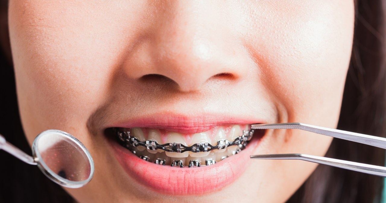 Takie leczenie kosztuje wiele tysięcy. Zapłaci NFZ, ale nie wszystkim