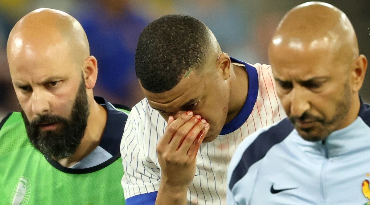 Zagra - nie zagra. We Francji złamany nos Kyliana Mbappe to sprawa narodowa. Atakujący Trójkolorowych skutecznie sam podsyca spekulacje dotyczące swojego ewentualnego występu w piątkowym meczu z Holandią. 